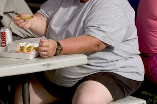 Obesidad Tratamiento